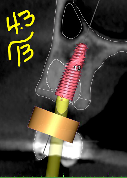 Fig. 5g