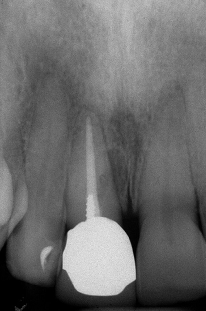 Fig. 2a