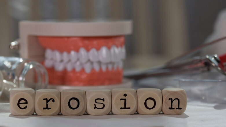 Une étude examine la manière dont les dentistes danois traitent l'érosion dentaire