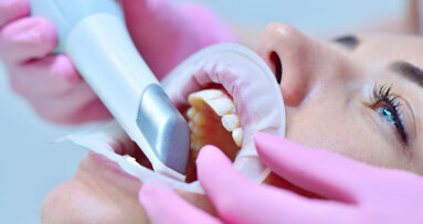 Study finds intra-oral scanner viable alternative to visual clinical evaluation in detecting caries
