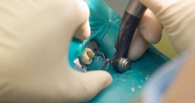Publicado guia clínico para casos complicados de endodontia