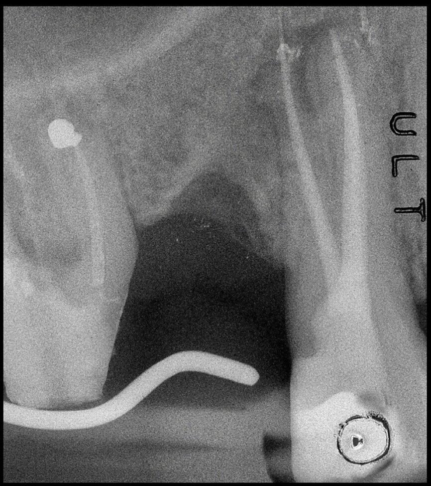 Fig. 23
