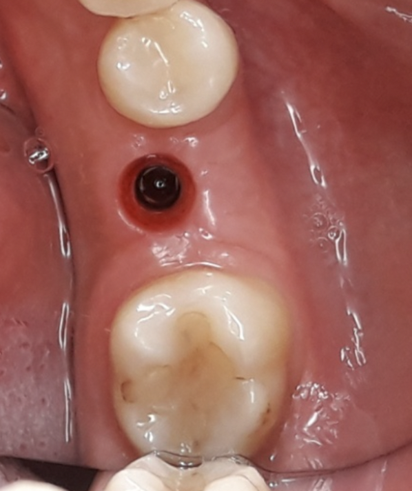 Fig. 1c