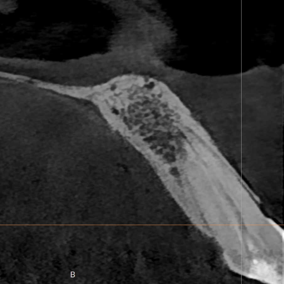 Fig. 1b