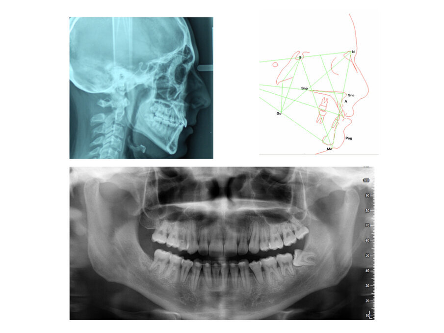 Fig. 6