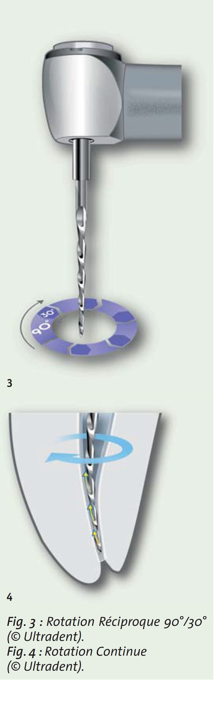 Fig. 3 : Rotation Reciproque 90°/30° (c Ultradent).