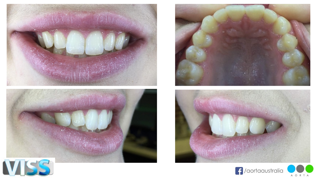 Fig. 47: Patient’s photograph to be considered in the treatment plan, alongside close-up photographs of the patient’s smile from different views.