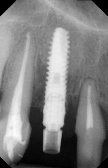 Fig. 15