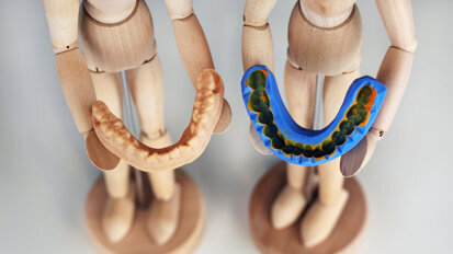 Digital impression taking in modern dentistry