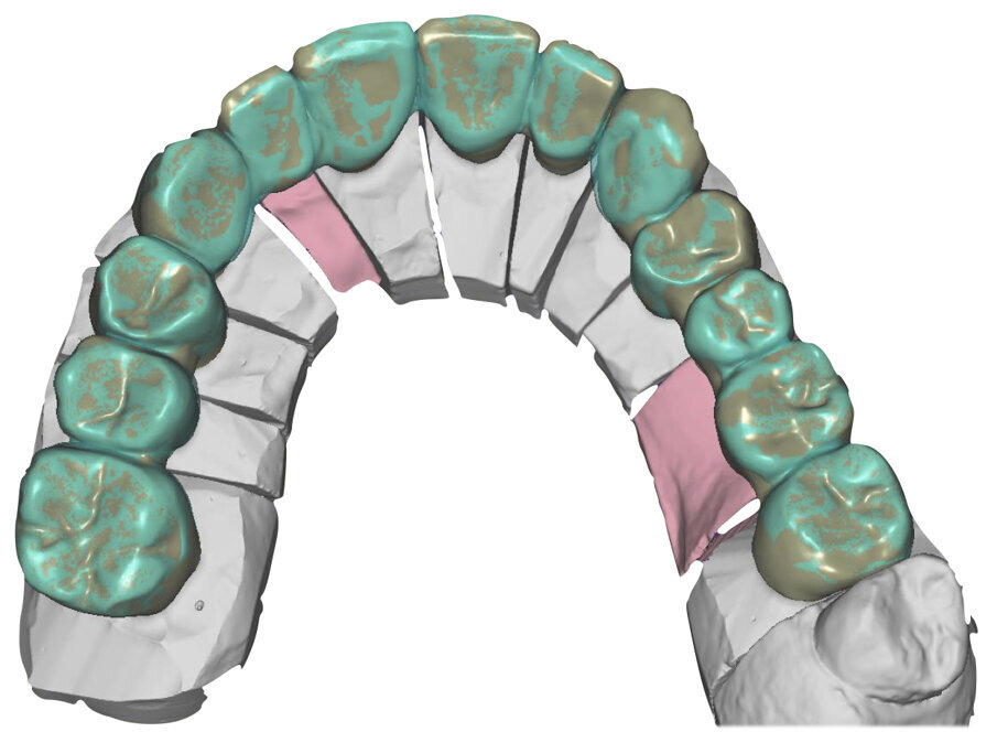Fig. 53