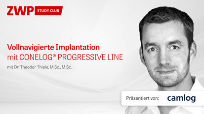 Vollnavigierte Implantation mit CONELOG PROGRESSIVE-LINE