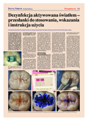 DT Poland