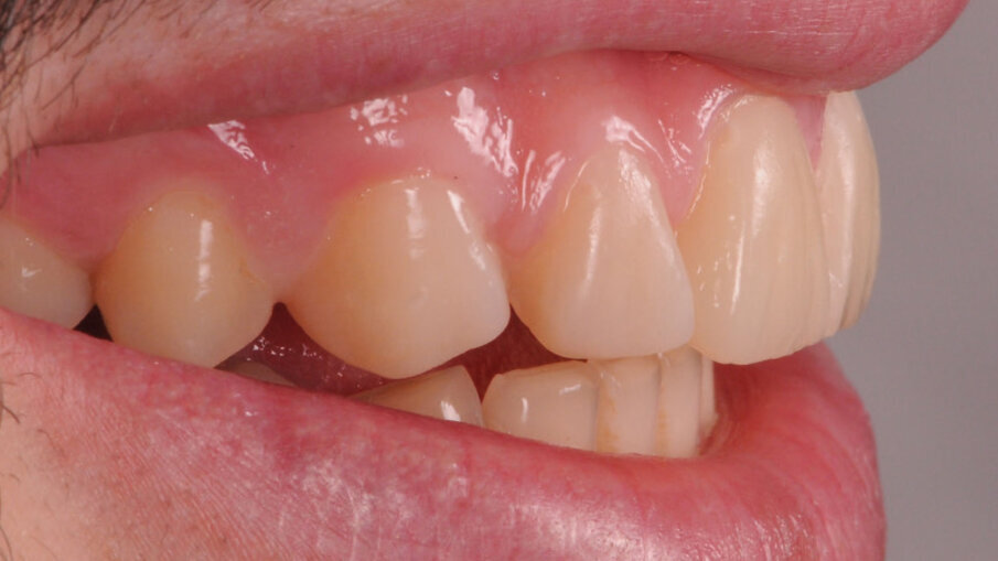 Fig. 8