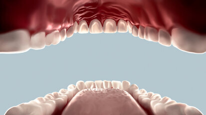 COVID-19 and the dental market: The pandemic continues to bite