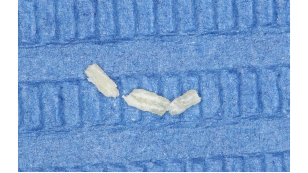Fig. 24: Calcified tissue that had extended for a few millimetres also inside the palatal canal and been removed using a 15/.04 Micro-Opener.