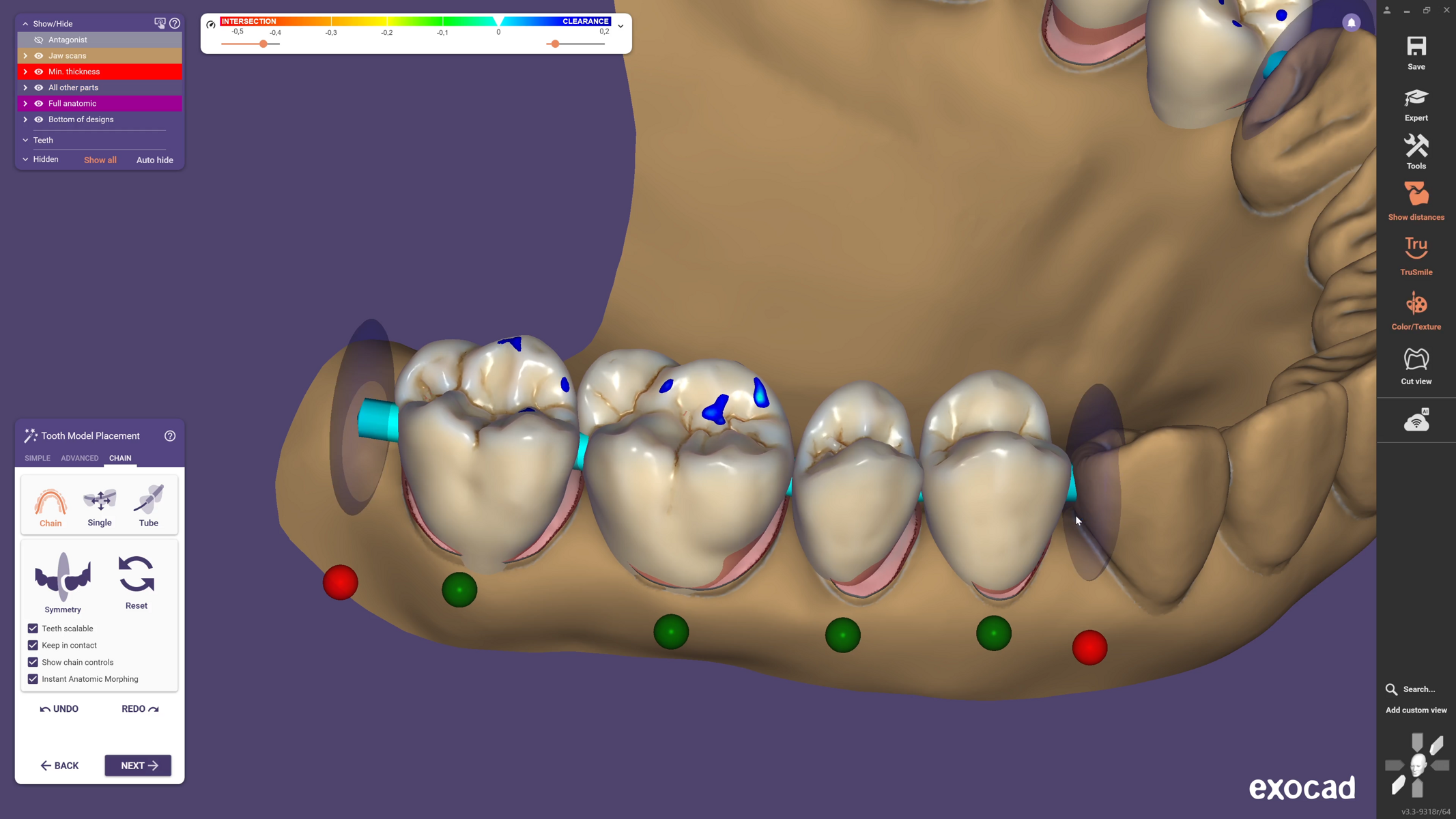 Exodad Rpds Exocad launches DentalCAD 3.3 Chemnitz