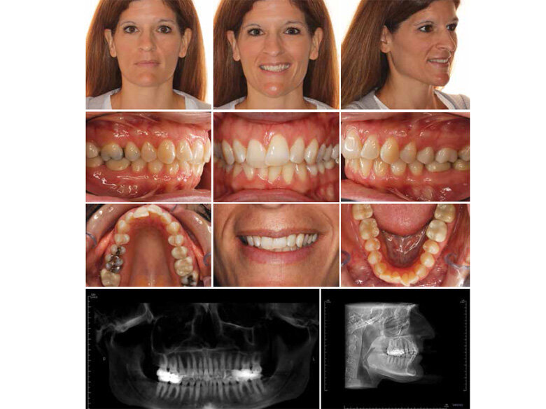 Fig. 3: Final records. (Photos: Michael J. Mayhew, DDS, MS, MS, & Nicole R. Scheffler, DDS, MS)