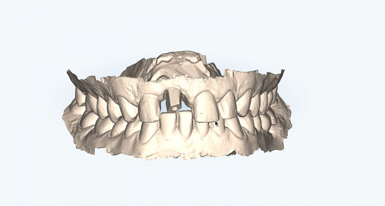 Afb. 9