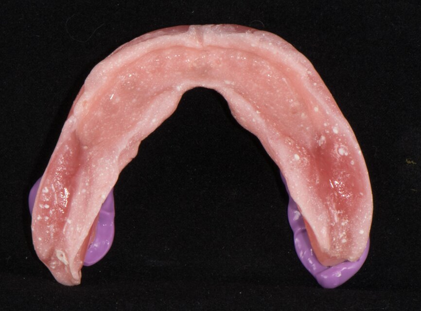 Fig. 3