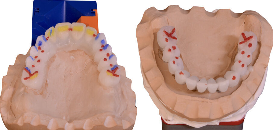 Fig. 18