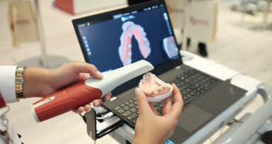Neoss unveils two novel implant solutions: NeoScan 2000 and NeoTell