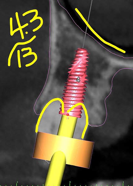Figs. 5b