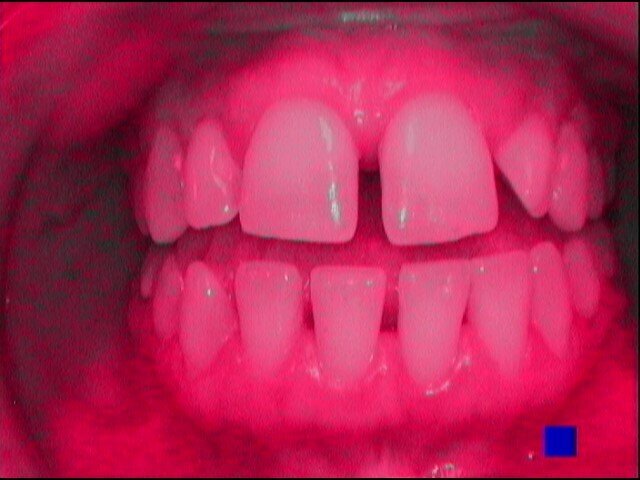 Fig. 3