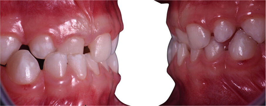 Fig. 19