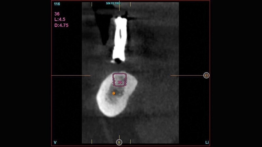 Fig. 6