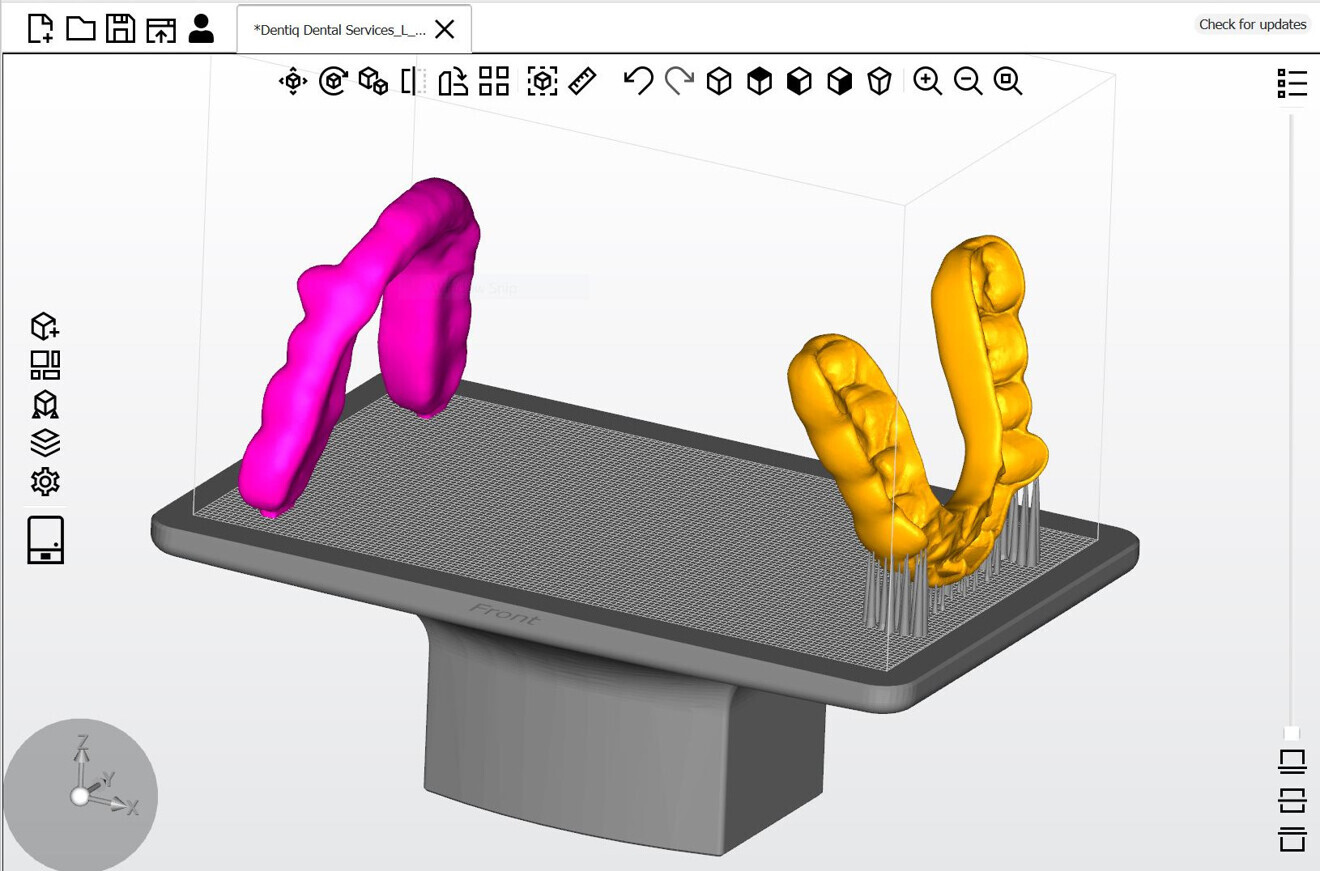 Fig. 6: View and position of the splint to be printed (Asiga Composer).