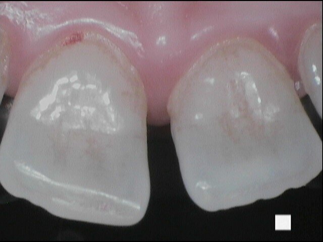 Fig. 4a