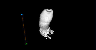 Engineers generate teeth from patients’ own gum cells