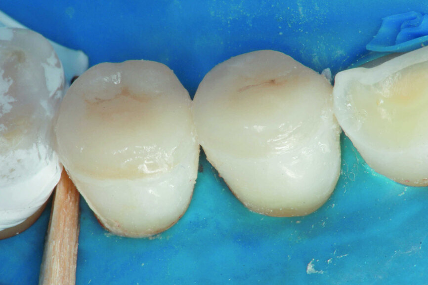 Fig.15