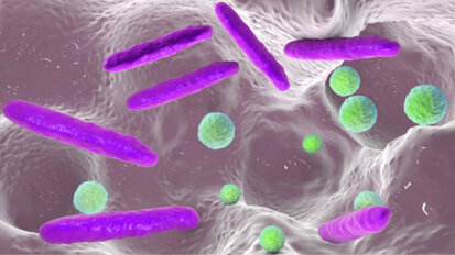 Resistance to anti-fungal drugs increased seen in severe childhood dental caries