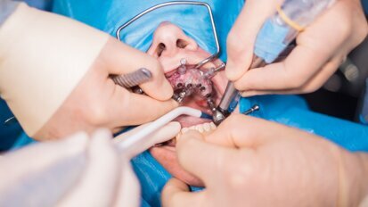 “Moving away from money-driven implantology to patient-centred care”
