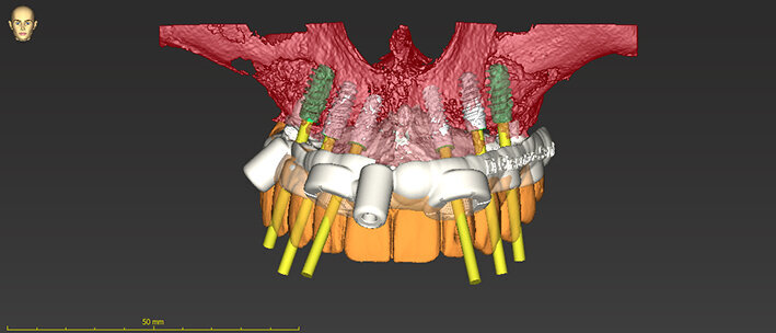 Fig. 40