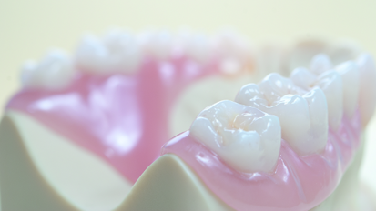 Thermoplastic materials in dental technology