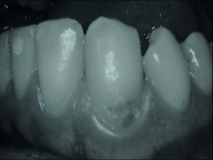 Fig. 2c