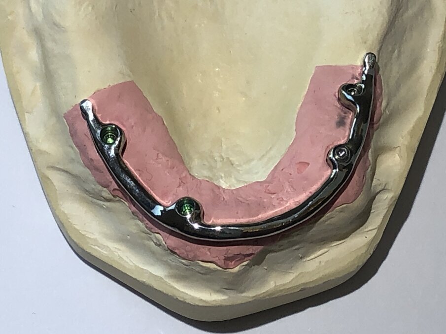 Afbeelding 14. CAD CAM gefreesde staafconstructie.