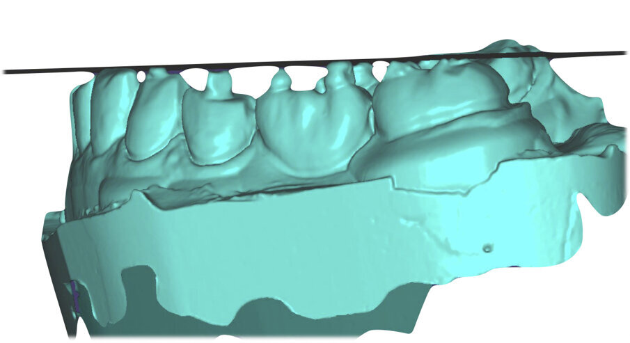 Fig. 28