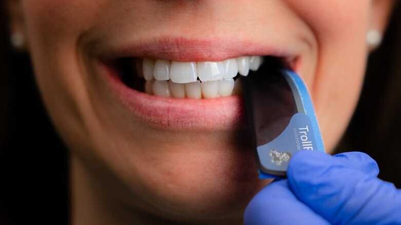 TrollFoil elimina as suposições do ajuste oclusal