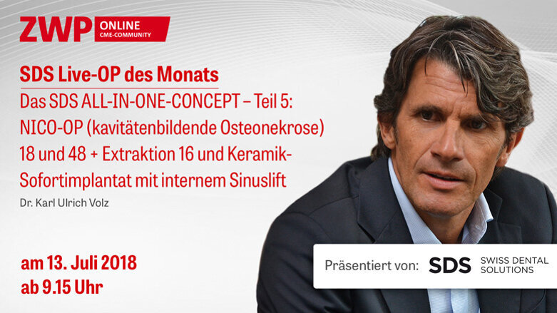 Live-OP am 13. Juli: „Das SDS ALL-IN-ONE-CONCEPT – Teil 5“