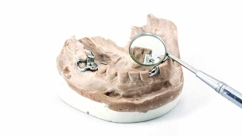 Verwendung von Cobalt in Dentallegierungen gerechtfertigt