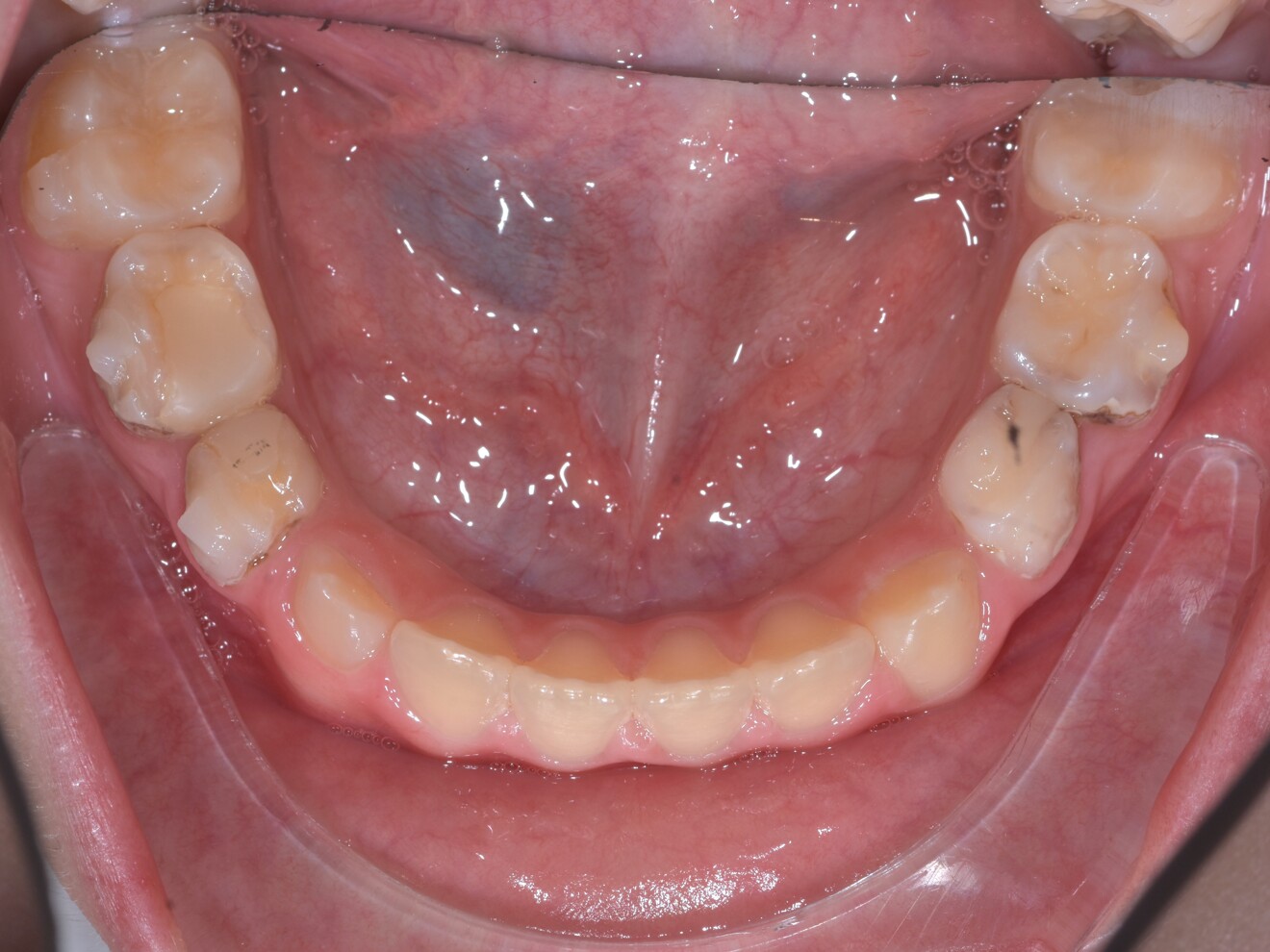 Fig. 2h