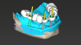 coDiagnostiX design the drill guide