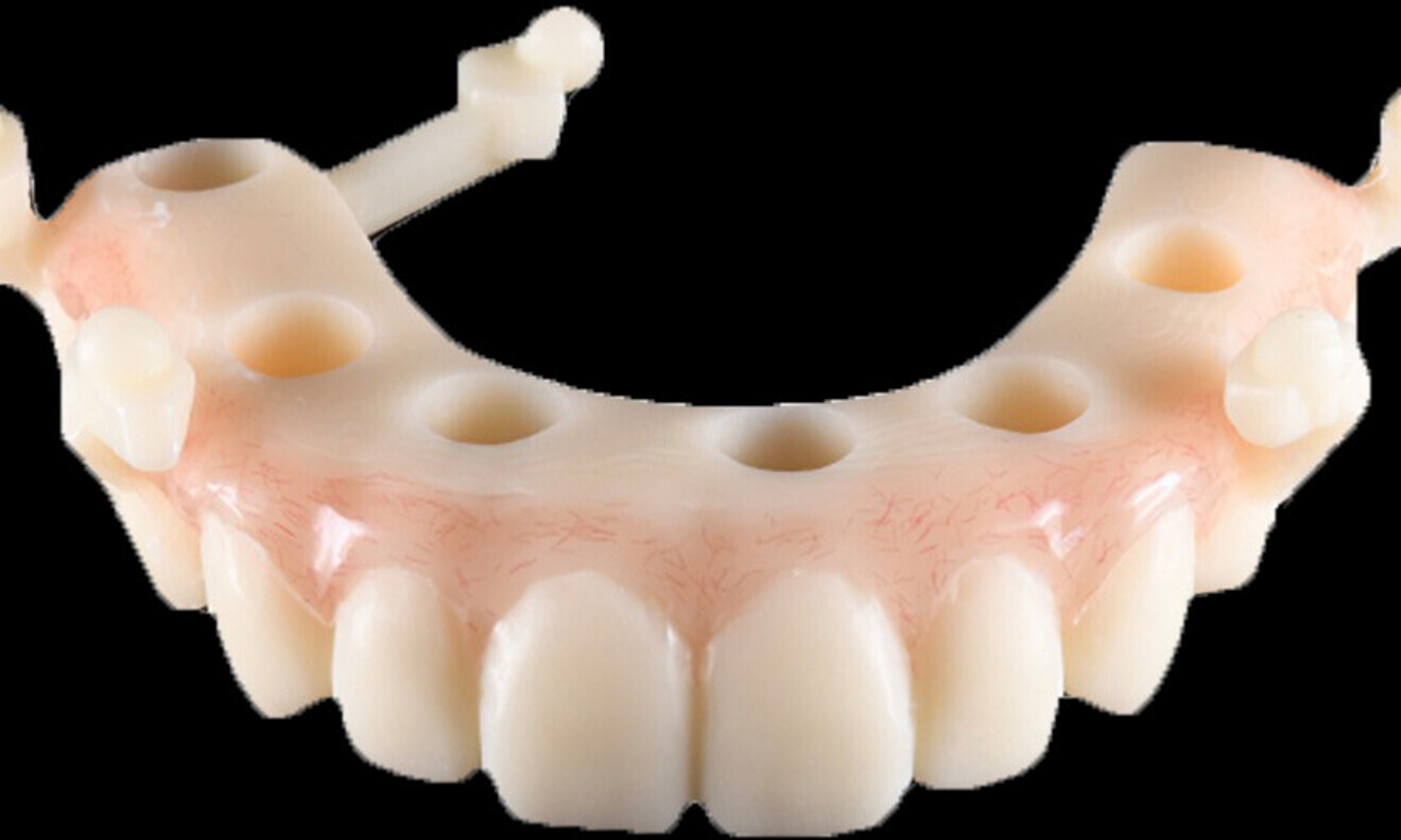Fig. 10