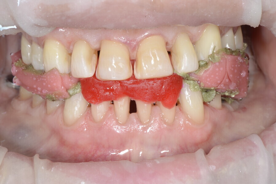 Fig. 24c