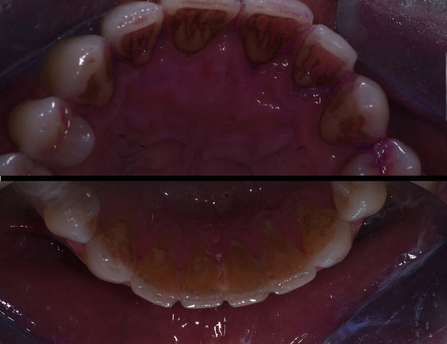 Fig. 6
