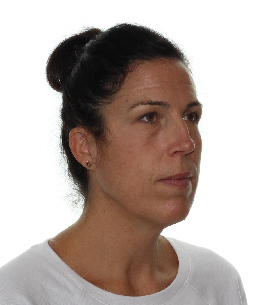Pre-treatment