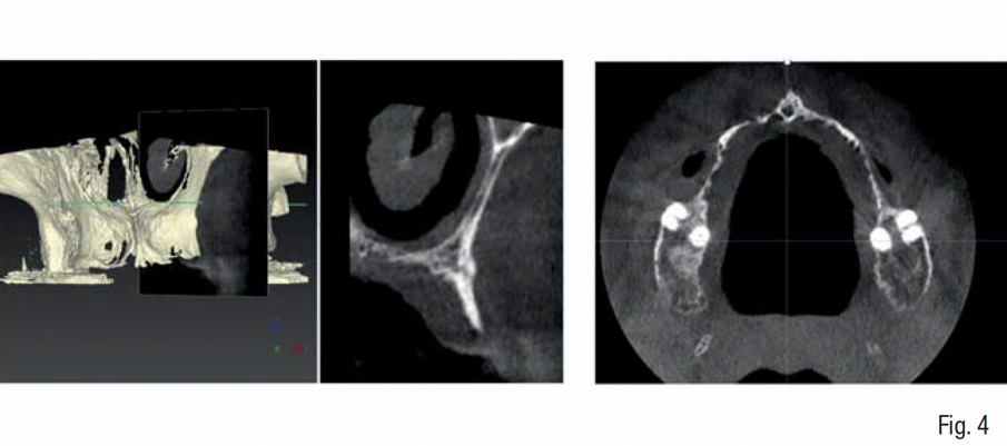 Fig. 4